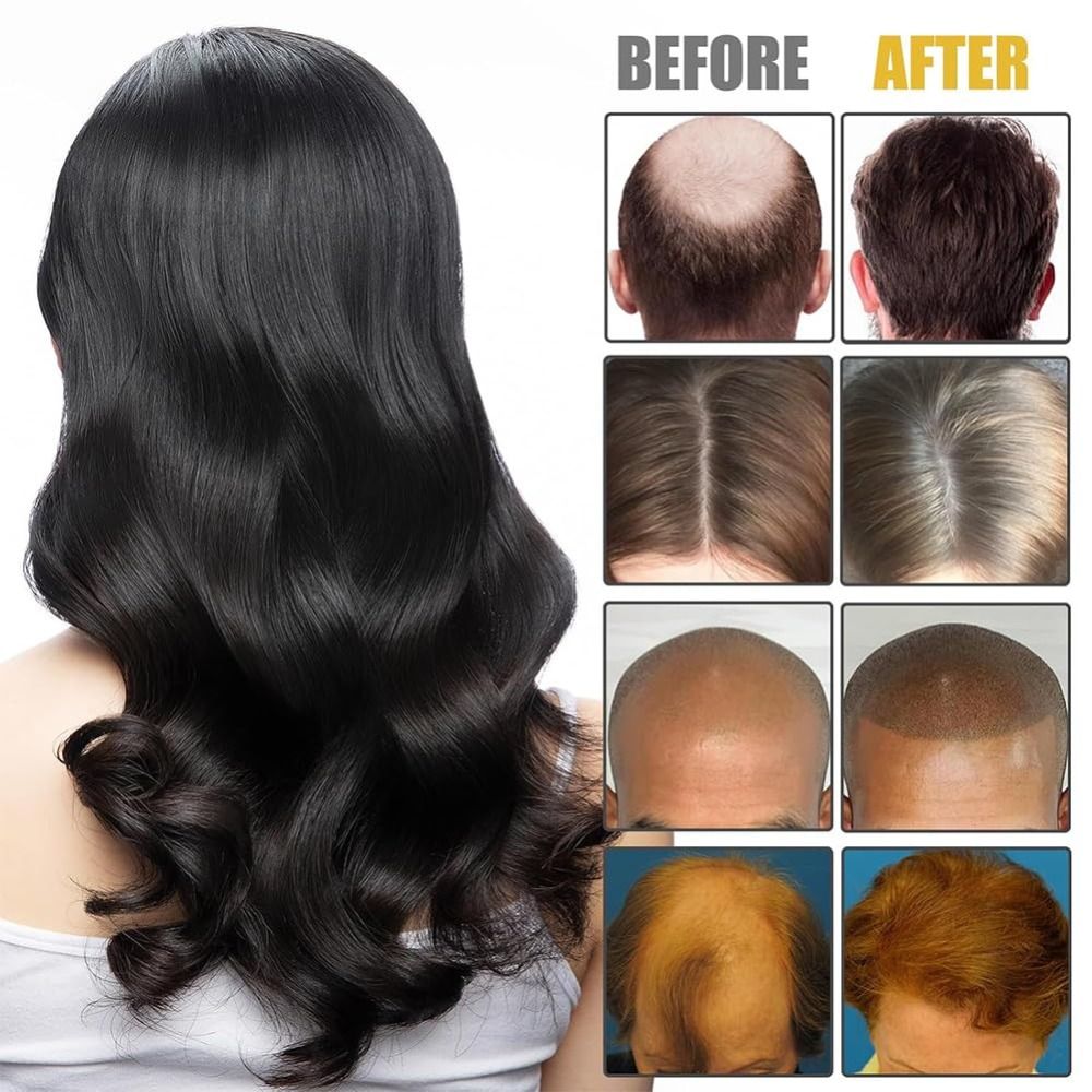 New Nourishes Hair Roots Vorte - Hair Care Formulation 评论和价格